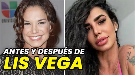 LIS VEGA, Antes y después de todo